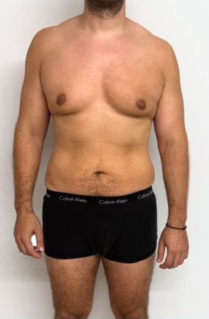 LiveUp Personal Training client (personal-training-1), front view, before