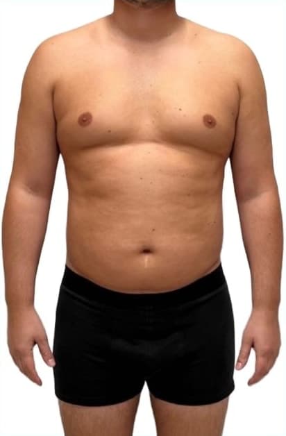 LiveUp Personal Training client (personal-training-4), front view, before