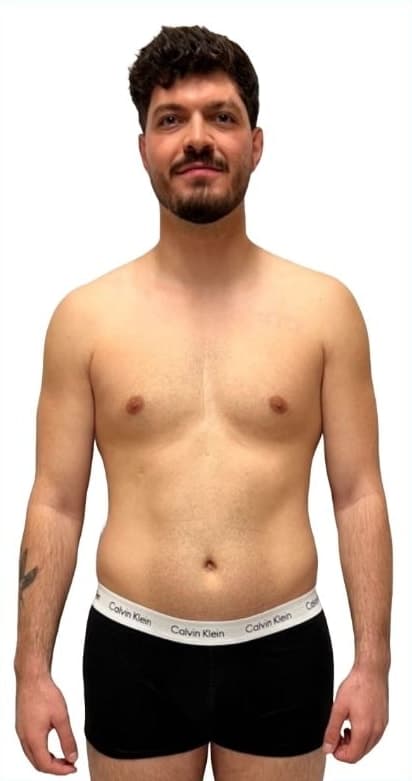 LiveUp Personal Training client (personal-training-8), front view, before